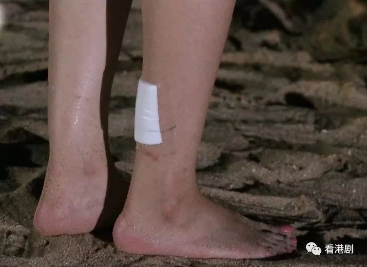 高海宁伤脚戒口百日杨明目击意外仲讲笑