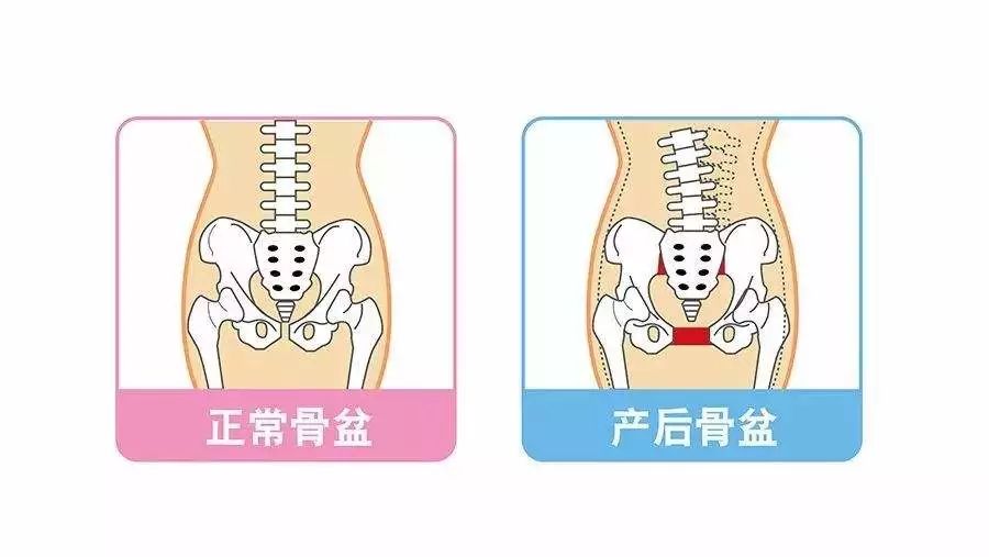 正常的骨盆