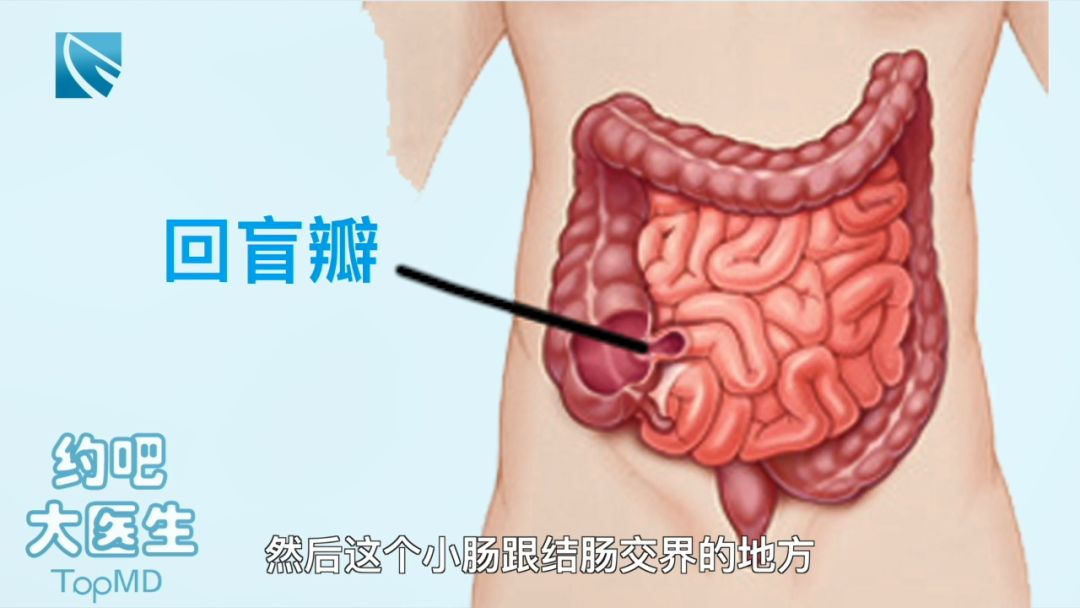 老师说胶囊胃镜查肿瘤靠谱吗最新研究这么说