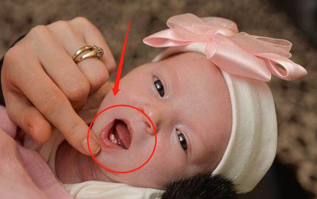 内行人讲出实话,父母要知道_乳牙