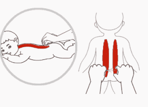 对婴幼儿可采取捏脊法.