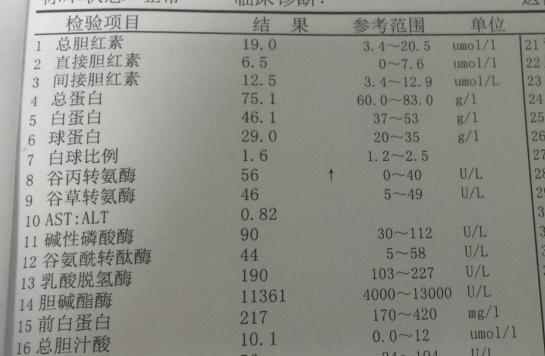 如何看肝功能报告结果?