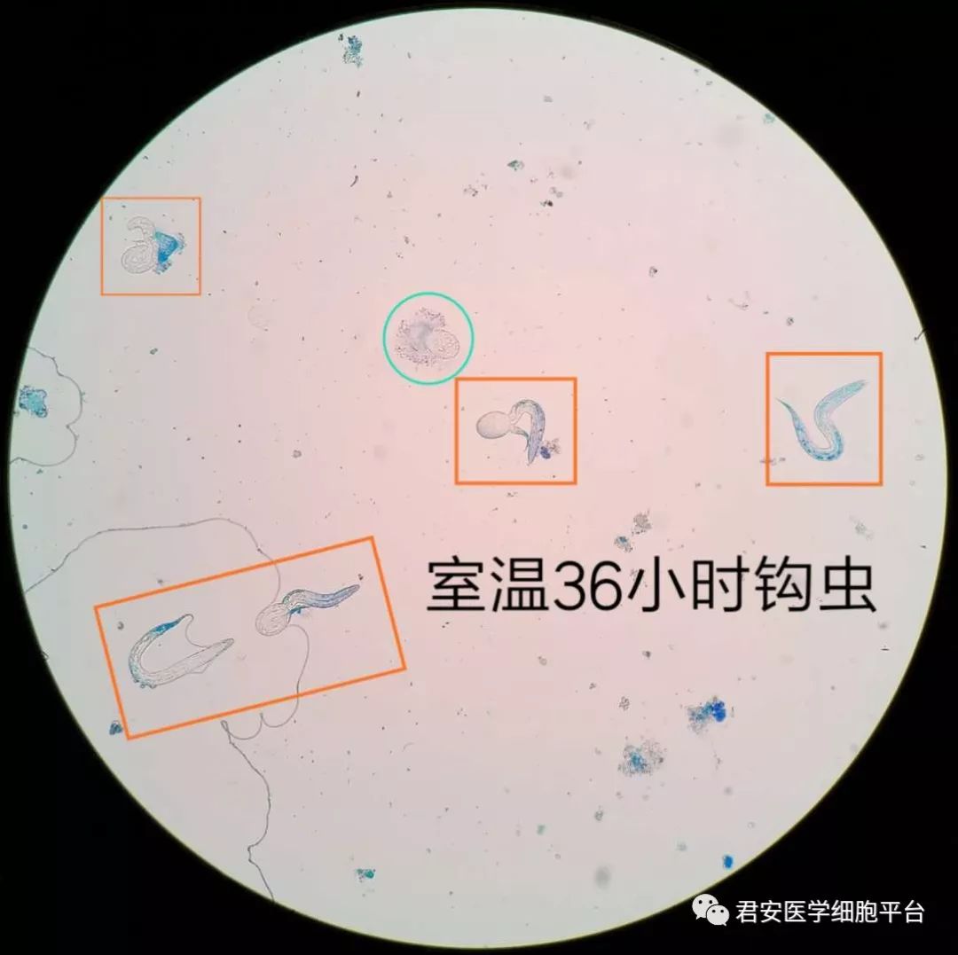 【独家报道】现场直播:钩虫宝宝破壳而出
