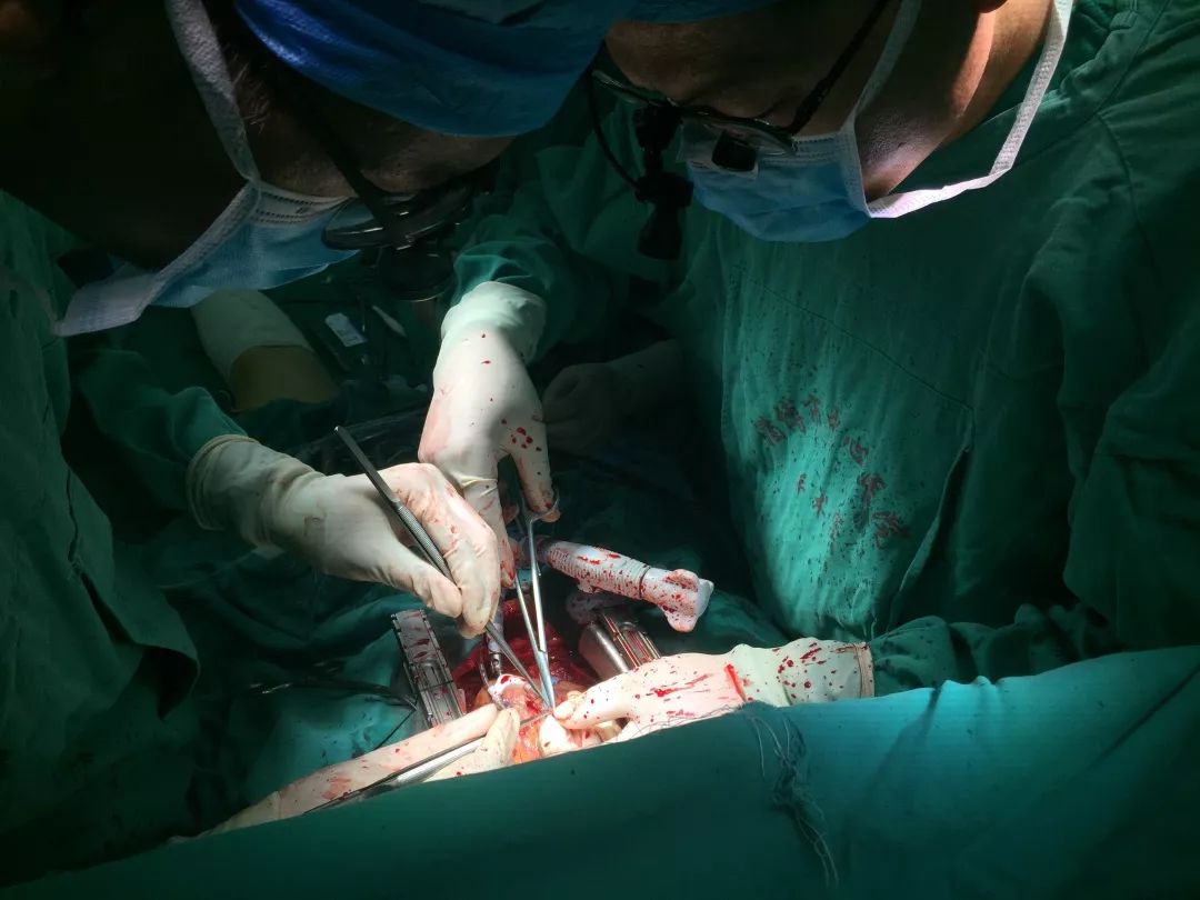与死神赛跑市中心医院心外科成功完成一例急症冠状动脉搭桥手术