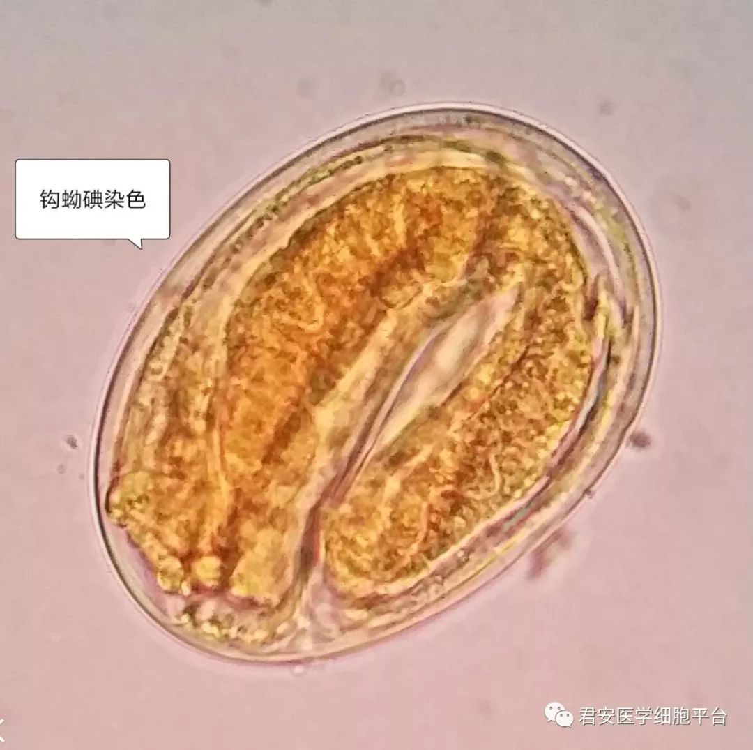 钩虫含蚴卵图片