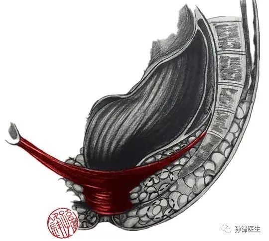 图(7):肛门外括约肌与肛提肌形成的"肌肉复合体"(红色显示)↑↑↑此外