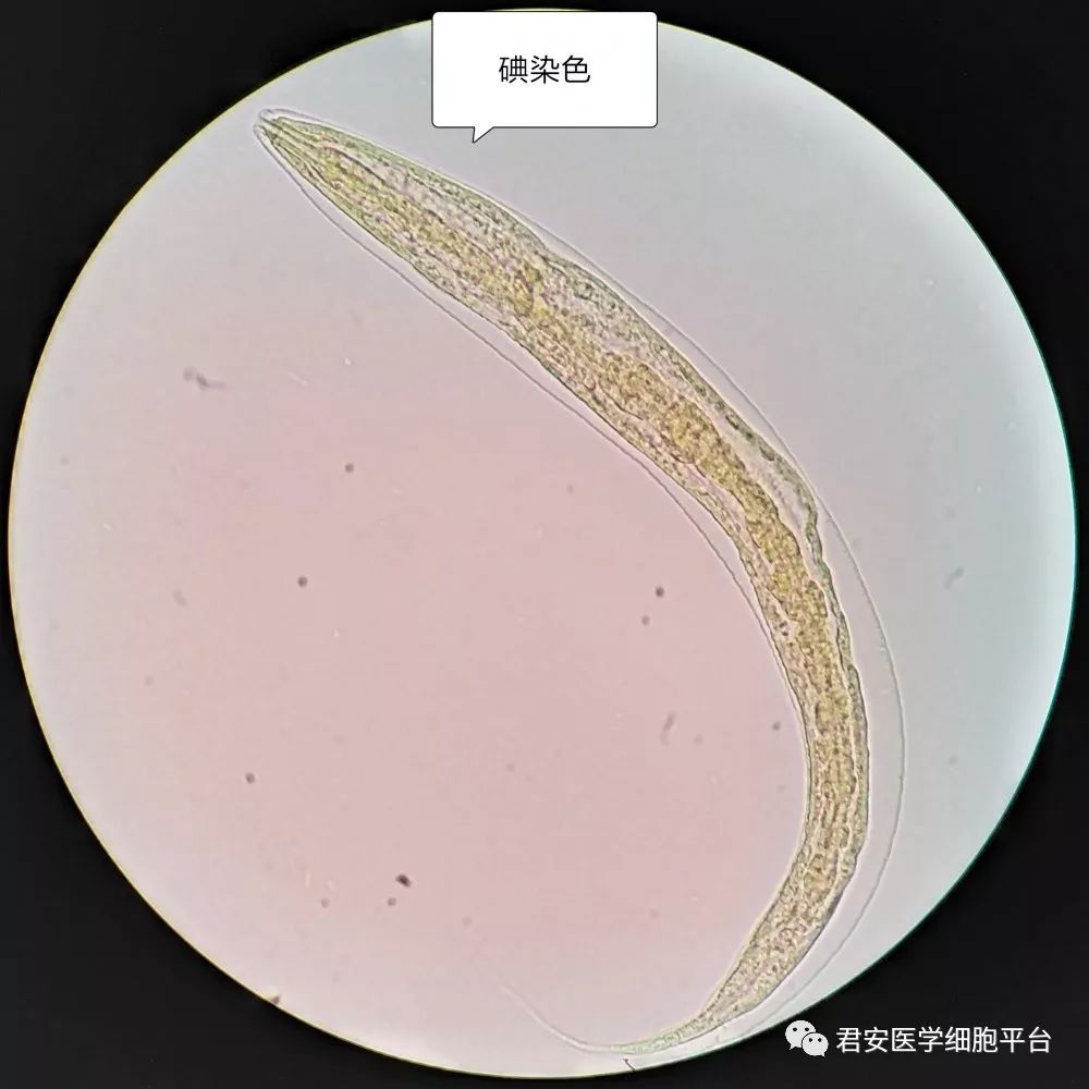 钩虫镜检图片图片