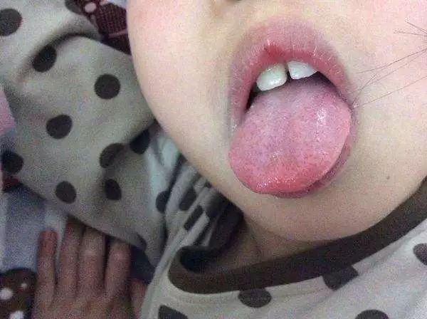 婴儿盼舌头图片图片