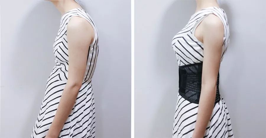 【老腰有救了】戴它3秒直腰,全天矫正,骨科医生都在用