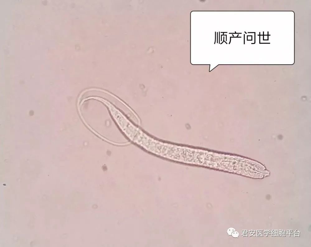 【独家报道】现场直播:钩虫宝宝破壳而出