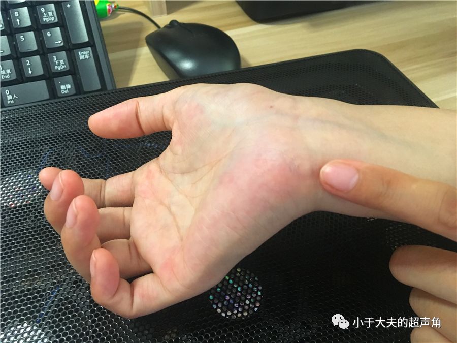 首先,我们先寻找近列"舟月三角豆"所形成的"碗",它的"碗缘"为舟状骨和