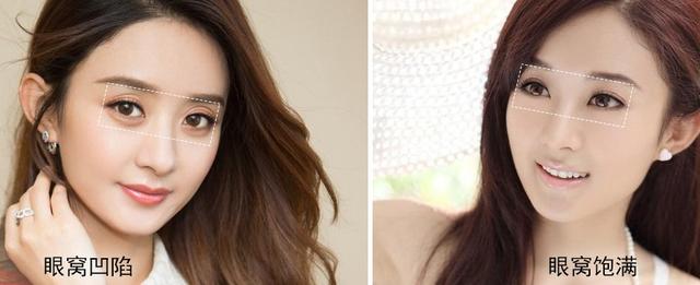 安茹拯救眼窝凹陷安茹有小妙招