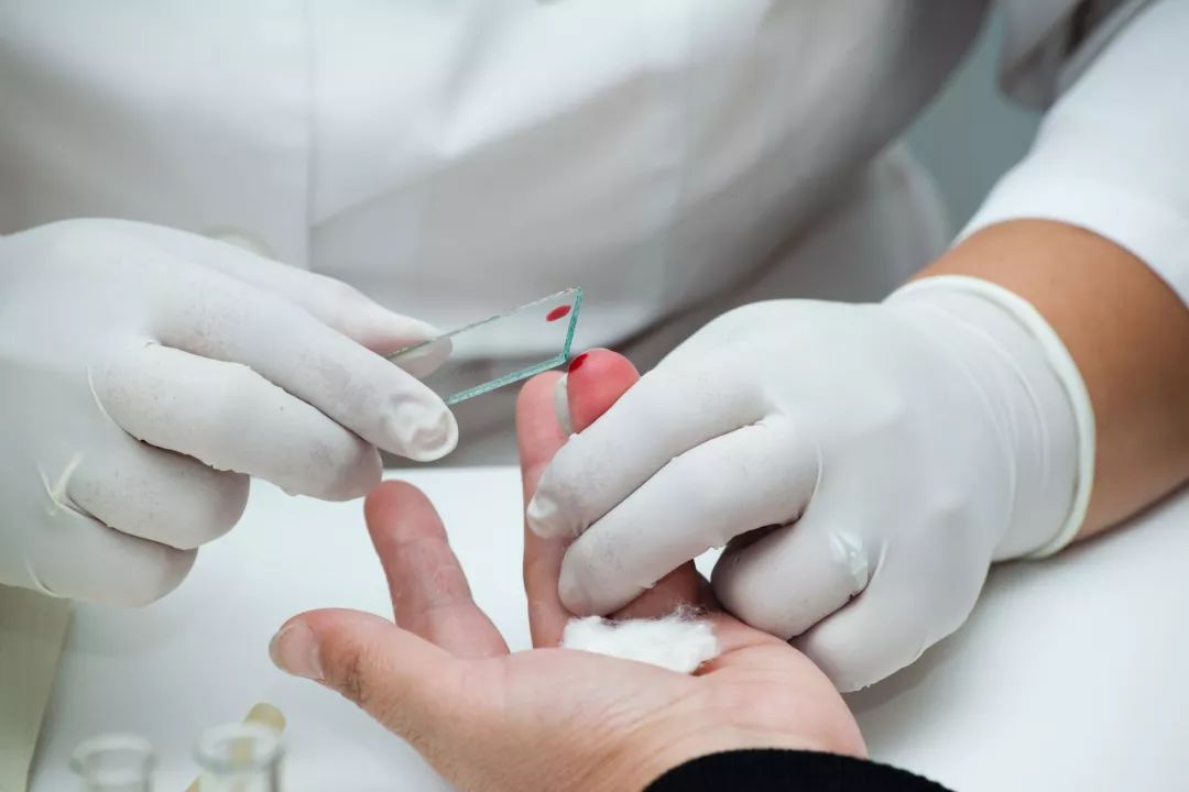 指尖采血 | 图虫创意指尖和耳垂采血后的止血相对简单,只要用棉球按住