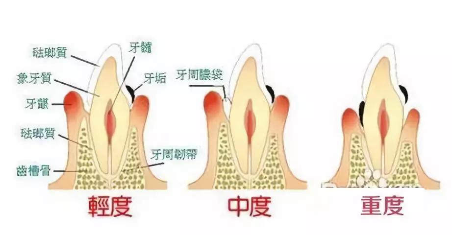 上牙床的位置图图片