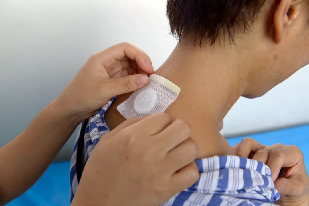 冬病夏治三伏贴固本培元保健康内附活动攻略快快分享参与