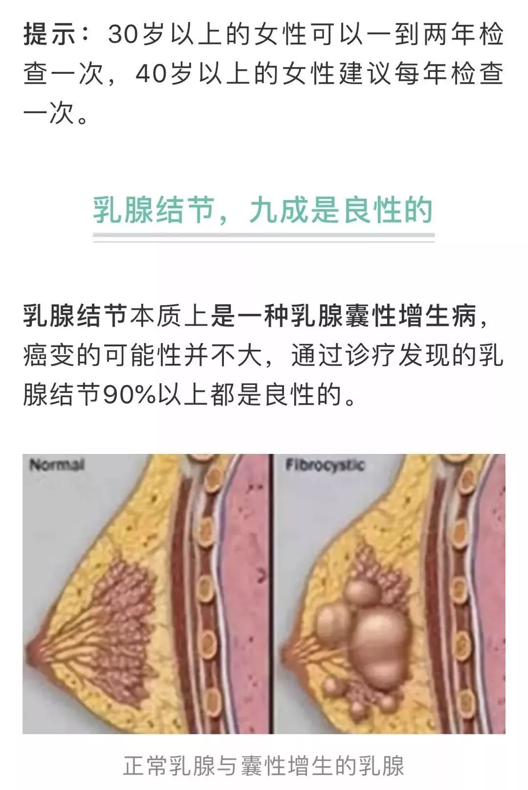 乐康肿瘤专家发现增生和结节怎么办乳腺专家教您对症处理