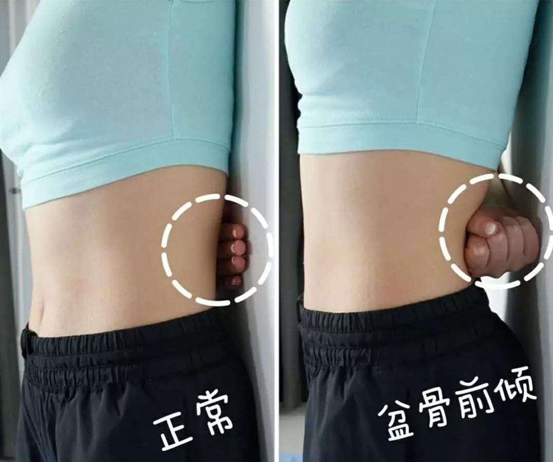 具体表现为腰部用力,向后翘臀,肚子往前凸.