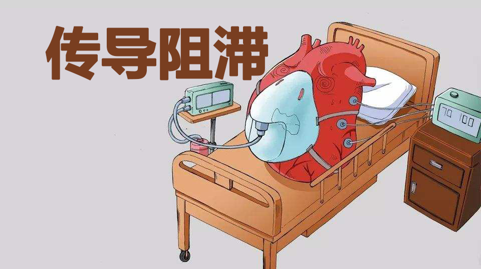心肌炎后出现早搏,传导阻滞怎么办