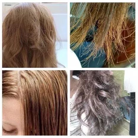 开团| 头屑多,头发油,还总掉发,这个洗护套装助您解决多种头发烦恼