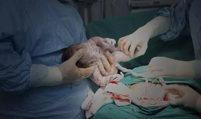 女性一生可以接受几次剖腹产_顺产