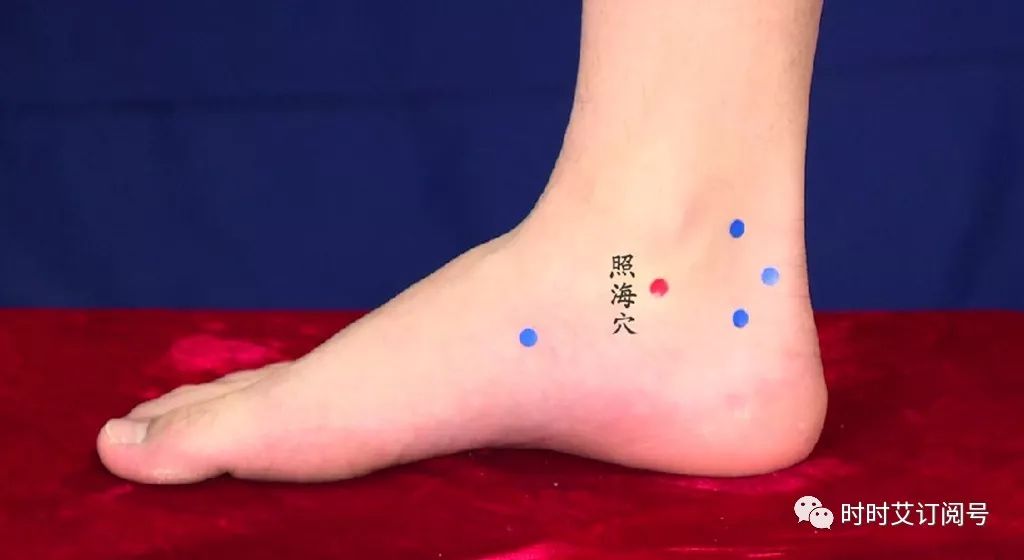 三伏天艾灸灸冬天少生病增强孩子免疫力