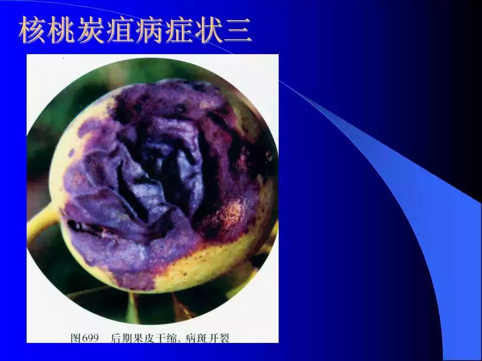 炭疽病图谱收集