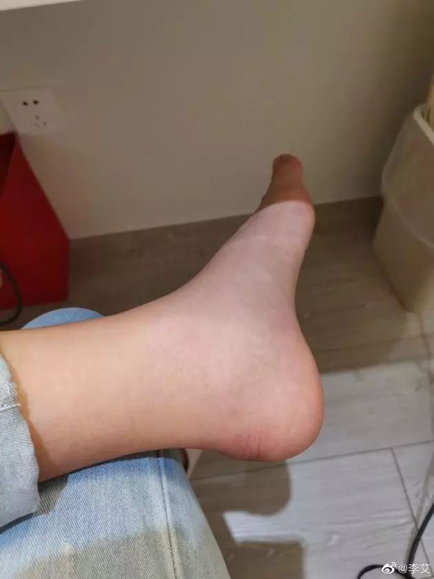 孕肿女星这样消肿,快让老公学起来!