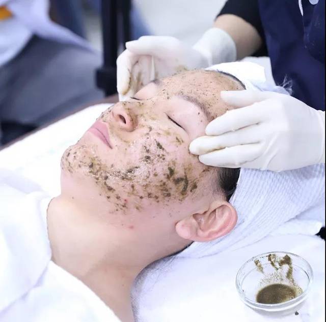 皮肤管理——背部痘痘和痘印怎么管理