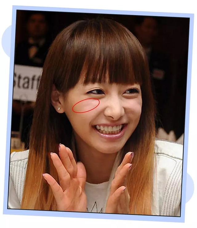 印第安纹"既不是泪沟,也不是法令纹颧骨的地方都有一条纹马思纯和宋茜