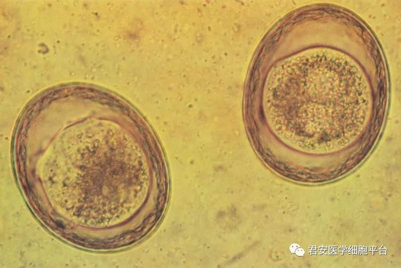 ▼「狮弓首蛔虫卵」形态特征:虫卵近圆形,大小为(75～85)μm ×(60