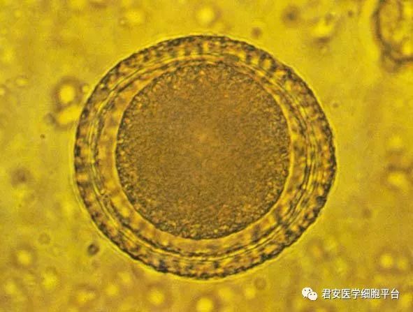 蛔虫卵脱蛋白质膜图图片