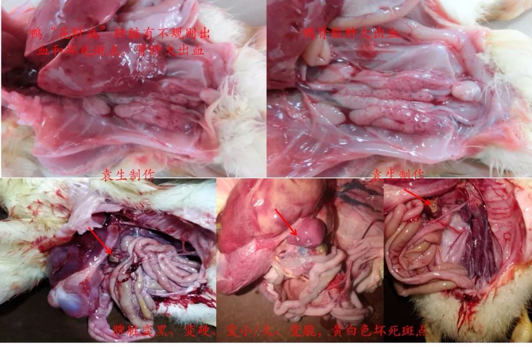 剖检案例:鸭呼肠孤病毒病病型临床症状:缩头,毛松,软脚,扎堆,减料