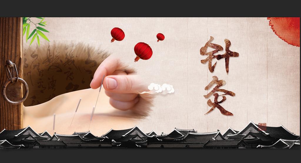 针灸减肥需要多长时间2个注意事项可能需要你先了解