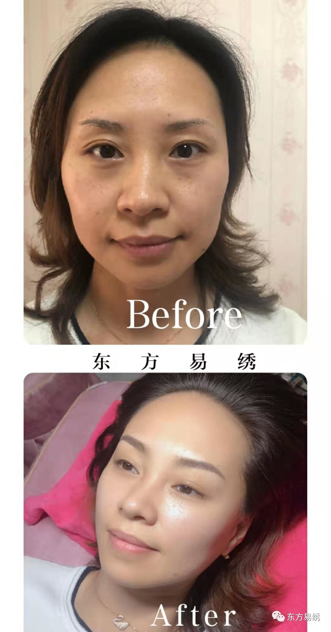雾眉 结痂掉痂的知识,get到你!_眉毛