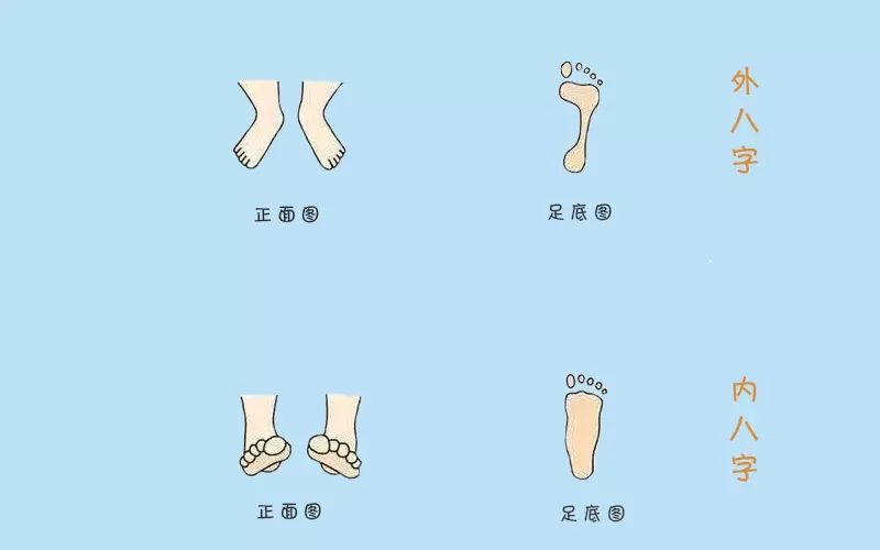 宝宝学走路外八字图片图片