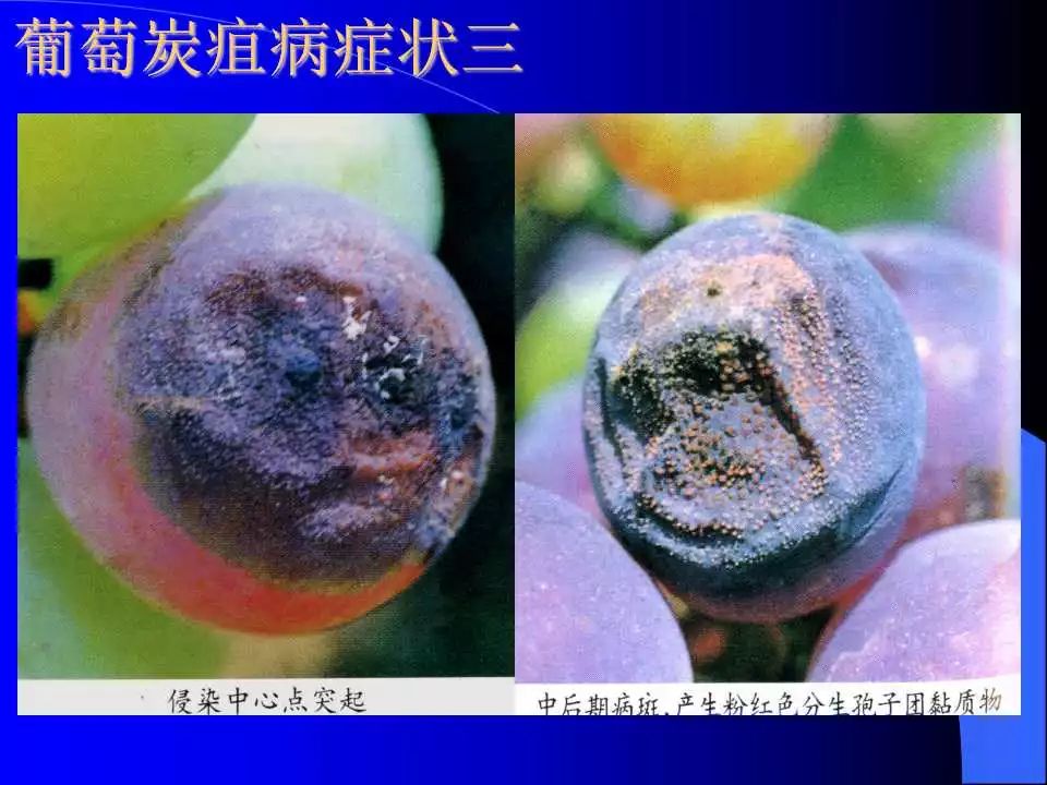 炭疽病图谱收集