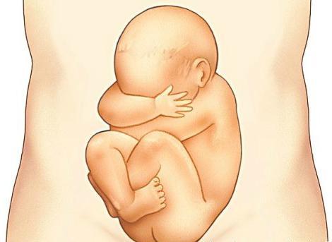如果胎儿智力有问题孕妈在孕期有哪些特殊的症状这四点要留意