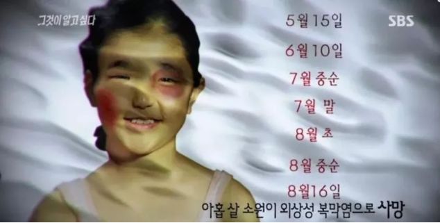 尸检发现,女孩是因内部器官破裂而死的,身上有多处不正常的外伤,所有