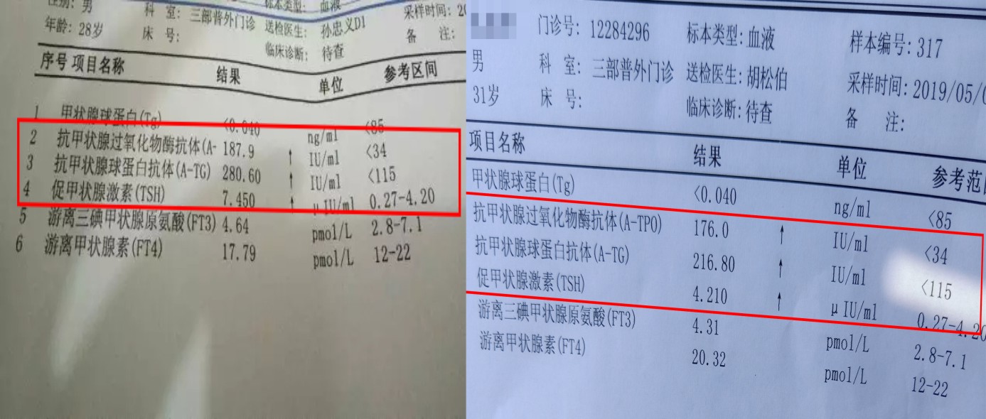 【真实案例】两张甲功报告记录3年桥本氏甲减患者辛酸