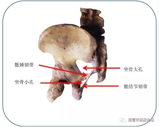 坐骨大孔是坐骨大切迹与骶棘韧带和骶结节韧带围成的孔.