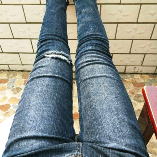 宝妈哺乳后胖了大腿根爆粗水动力大腿环吸术分享附攻略