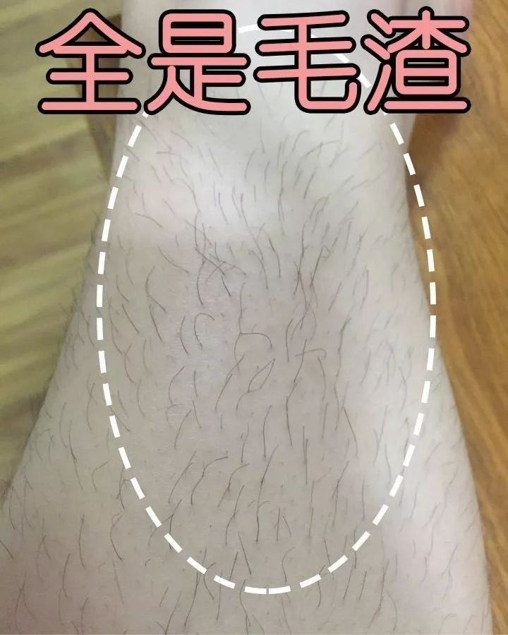 你的"腿毛"答应吗?