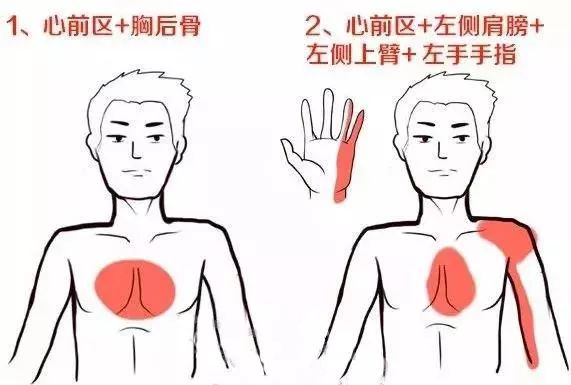 这9个部位疼痛可能预示已经患有心梗