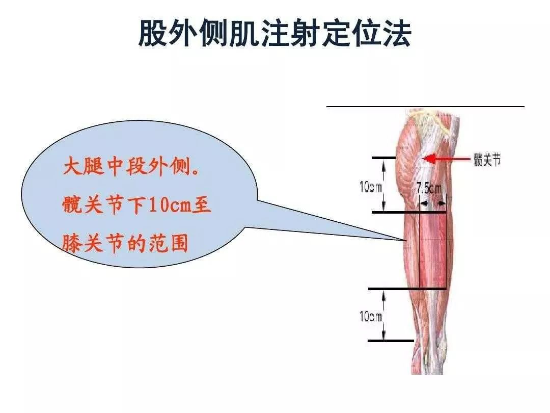 臀大肌注射部位示意图图片