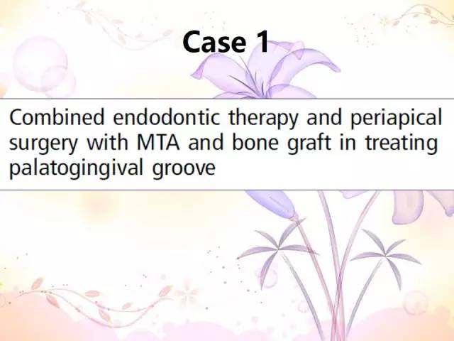 畸形舌侧沟临床对策