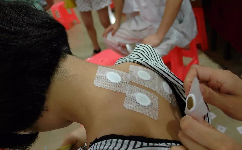 明天小雨又来!三伏贴最全攻略都在这