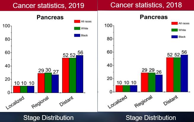 男性胰腺癌发病率进入前十, 2019年和2018年发病率,新发病例分期,就诊