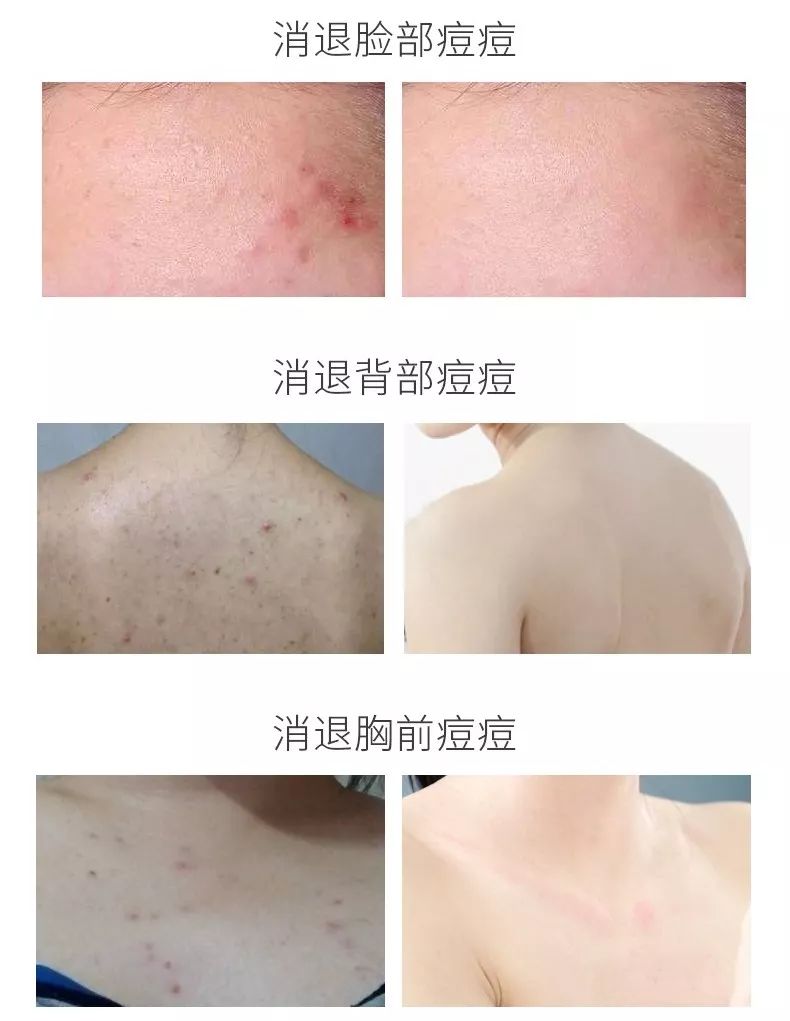 日本变态皂!30秒揪出千万螨虫,痘痘,体臭全无,比10个搓澡大妈还猛