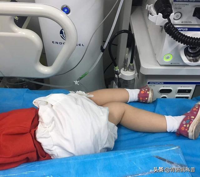 原创4岁孩子长期便血长不胖原来是这个原因