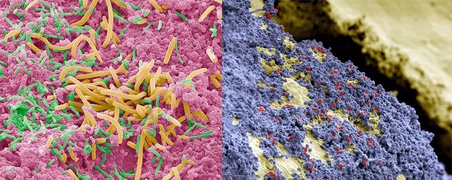 设计团队深入研究了这些附着在牙齿上的细菌